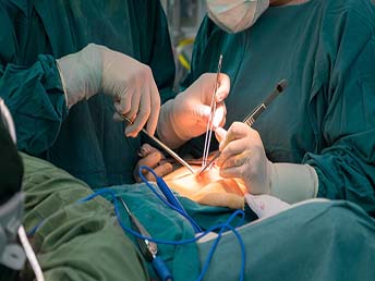 General Surgery